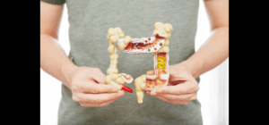 Showcasing constipation issue in brisbane